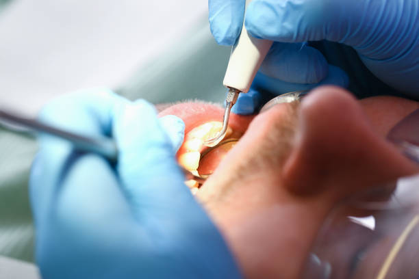 Best Broken Tooth Emergency  in Gardner, KS